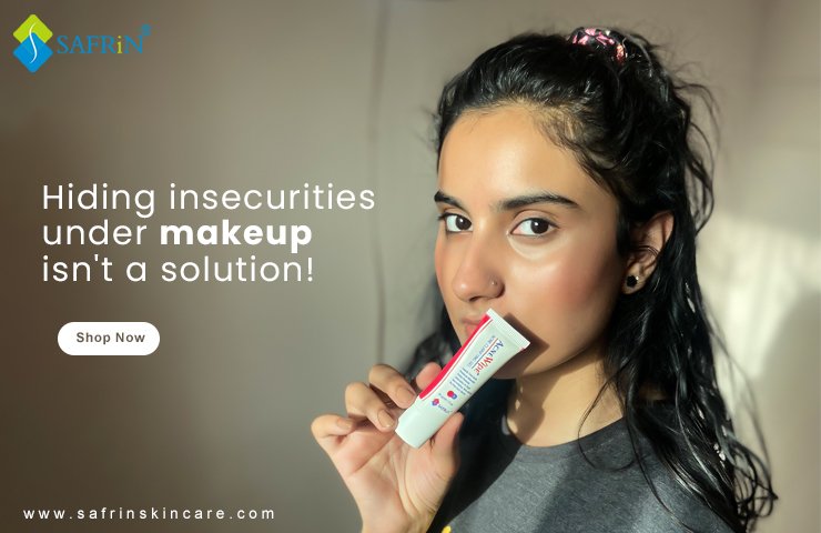 pimple gel in Pakistan